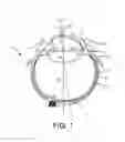 Fig. 02 - Expandable drug delivery devices and methods of use