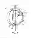 Fig. 03 - Expandable drug delivery devices and methods of use