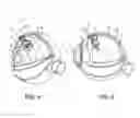 Fig. 05 - Expandable drug delivery devices and methods of use