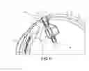 Fig. 06 - Expandable drug delivery devices and methods of use