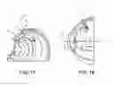 Fig. 14 - Expandable drug delivery devices and methods of use