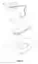 Fig. 10 - Wound pad