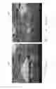 Fig. 08 - Process and apparatus for manufacturing an absorbent article using a laser source