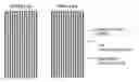 Fig. 01 - Systems and methods for improving sensory eye dominance, binocular imbalance, and/or stereopsis in a subject