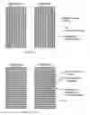 Fig. 03 - Systems and methods for improving sensory eye dominance, binocular imbalance, and/or stereopsis in a subject
