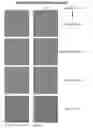 Fig. 08 - Systems and methods for improving sensory eye dominance, binocular imbalance, and/or stereopsis in a subject