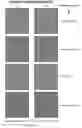 Fig. 09 - Systems and methods for improving sensory eye dominance, binocular imbalance, and/or stereopsis in a subject