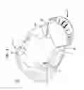 Fig. 04 - System for alleviating symptoms of a neurological disorder