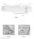 Fig. 04 - BIOADHESIVE FILMS FOR LOCAL AND/OR SYSTEMIC DELIVERY