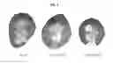 Fig. 03 - PPAR GAMMA MODULATORS FOR TREATING CYSTIC DISEASES