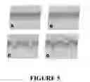 Fig. 06 - Method for Preventing and/or Treating Chronic Traumatic Encephalopathy - IV