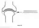 Fig. 11 - USE OF MESOTHELIAL CELLS IN TISSUE BIOENGINEERING AND ARTIFICIAL TISSUES