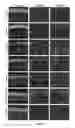 Fig. 16 - USE OF MESOTHELIAL CELLS IN TISSUE BIOENGINEERING AND ARTIFICIAL TISSUES