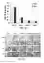 Fig. 11 - COMPOSITION FOR WOUND-HEALING COMPRISING ADULT STEM CELLS AND ELASTIN-LIKE POLYPEPTIDES