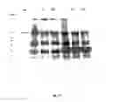 Fig. 14 - Purified amniotic membrane compositions and methods of use