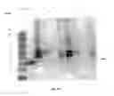 Fig. 15 - Purified amniotic membrane compositions and methods of use