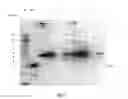 Fig. 18 - Purified amniotic membrane compositions and methods of use