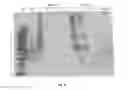 Fig. 19 - Purified amniotic membrane compositions and methods of use
