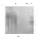Fig. 12 - Amniotic membrane preparations and purified compositions and therapy for scar reversal and inhibition