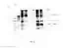 Fig. 13 - Amniotic membrane preparations and purified compositions and therapy for scar reversal and inhibition