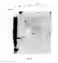 Fig. 16 - Amniotic membrane preparations and purified compositions and therapy for scar reversal and inhibition
