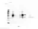 Fig. 17 - Amniotic membrane preparations and purified compositions and therapy for scar reversal and inhibition