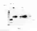 Fig. 18 - Amniotic membrane preparations and purified compositions and therapy for scar reversal and inhibition