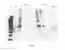 Fig. 19 - Amniotic membrane preparations and purified compositions and therapy for scar reversal and inhibition