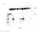 Fig. 20 - Amniotic membrane preparations and purified compositions and therapy for scar reversal and inhibition