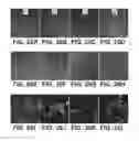 Fig. 27 - Amniotic membrane preparations and purified compositions and therapy for scar reversal and inhibition