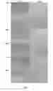 Fig. 07 - Amniotic membrane preparations and purified compositions and anti-angiogenesis treatment