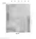 Fig. 11 - Amniotic membrane preparations and purified compositions and anti-angiogenesis treatment