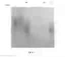 Fig. 12 - Amniotic membrane preparations and purified compositions and anti-angiogenesis treatment