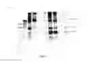 Fig. 13 - Amniotic membrane preparations and purified compositions and anti-angiogenesis treatment