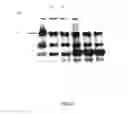 Fig. 14 - Amniotic membrane preparations and purified compositions and anti-angiogenesis treatment