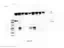 Fig. 20 - Amniotic membrane preparations and purified compositions and anti-angiogenesis treatment