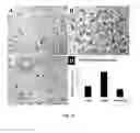 Fig. 25 - Amniotic membrane preparations and purified compositions and anti-angiogenesis treatment