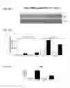 Fig. 06 - COMPOSITIONS, METHODS AND USES FOR ALPHA-1 ANTITRYPSIN OR DERIVATIVES THEREOF