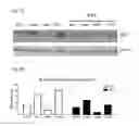 Fig. 10 - COMPOSITIONS, METHODS AND USES FOR ALPHA-1 ANTITRYPSIN OR DERIVATIVES THEREOF
