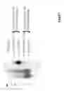 Fig. 02 - Factor VIIa-polysialic acid conjugates having prolonged in vivo half-life