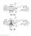 Fig. 19 - Shielded targeting agents, methods, and in vivo diagnostic system