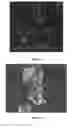 Fig. 04 - Nano-calcium phosphate-coated polymethylmethacrylate-based co-polymer and coating process of the same