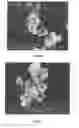 Fig. 05 - Nano-calcium phosphate-coated polymethylmethacrylate-based co-polymer and coating process of the same