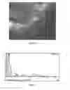 Fig. 08 - Nano-calcium phosphate-coated polymethylmethacrylate-based co-polymer and coating process of the same