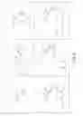 Fig. 10 - IMIDATED BIOPOLYMER ADHESIVE AND HYDROGEL