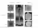 Fig. 10 - MUSCULOSKELETAL TISSUE FABRICATION