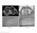 Fig. 35 - MUSCULOSKELETAL TISSUE FABRICATION