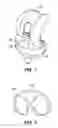 Fig. 02 - Method of a Pharmaceutical Delivery System for Use Within a Joint Replacement