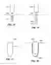 Fig. 09 - Method of a Pharmaceutical Delivery System for Use Within a Joint Replacement