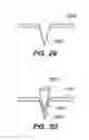 Fig. 13 - Method of a Pharmaceutical Delivery System for Use Within a Joint Replacement